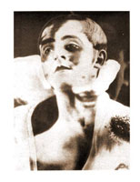 E.F. Burian jako Oidipus